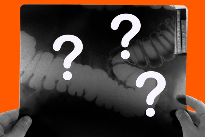 九游app：柳叶刀惊曝：AI让医生6个月「废功」20%癌症检出率崩盘！(图7)