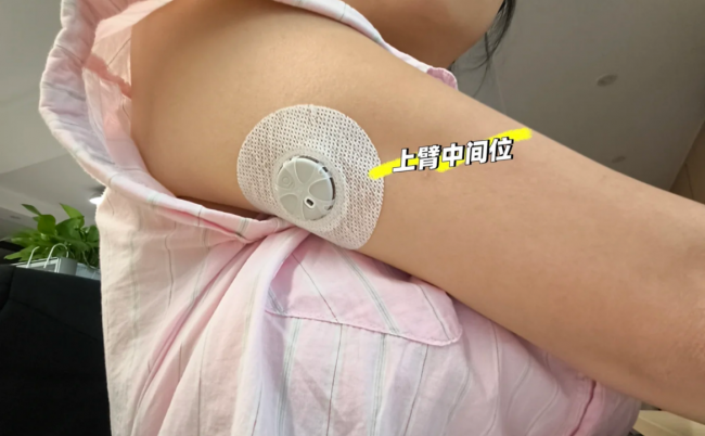 九游体育：动态血糖仪品牌对比2026：谁把高精度做成了日常可及？(图4)